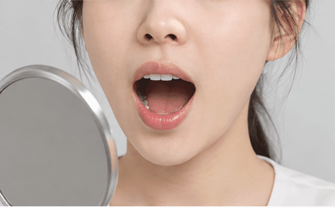 자가진단 2 - 거울을 보며 입을 크게 벌려 유지하는 모습
