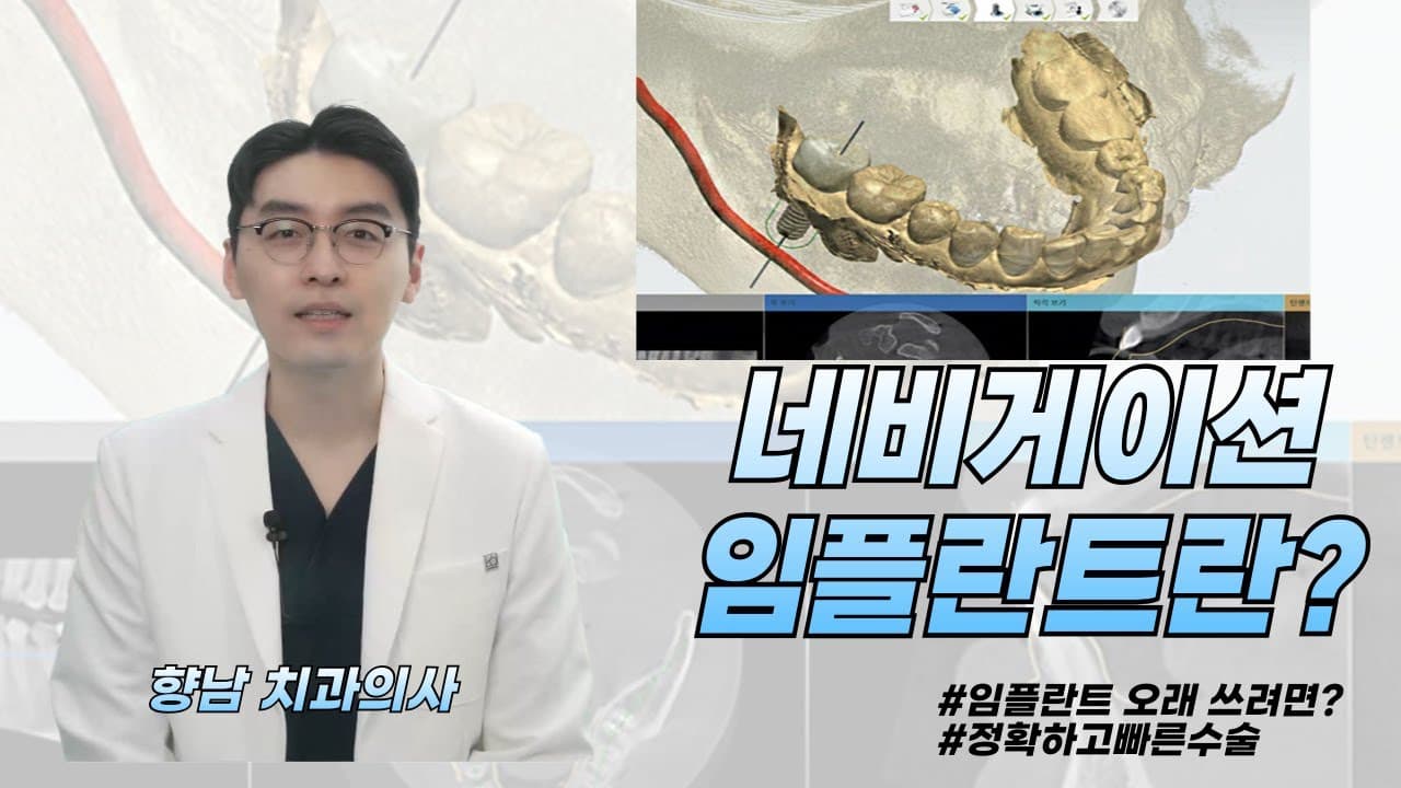 바로드림치과 유튜브 · 더 오래 쓰는 임플란트, 네비게이션 임플란트로 해결