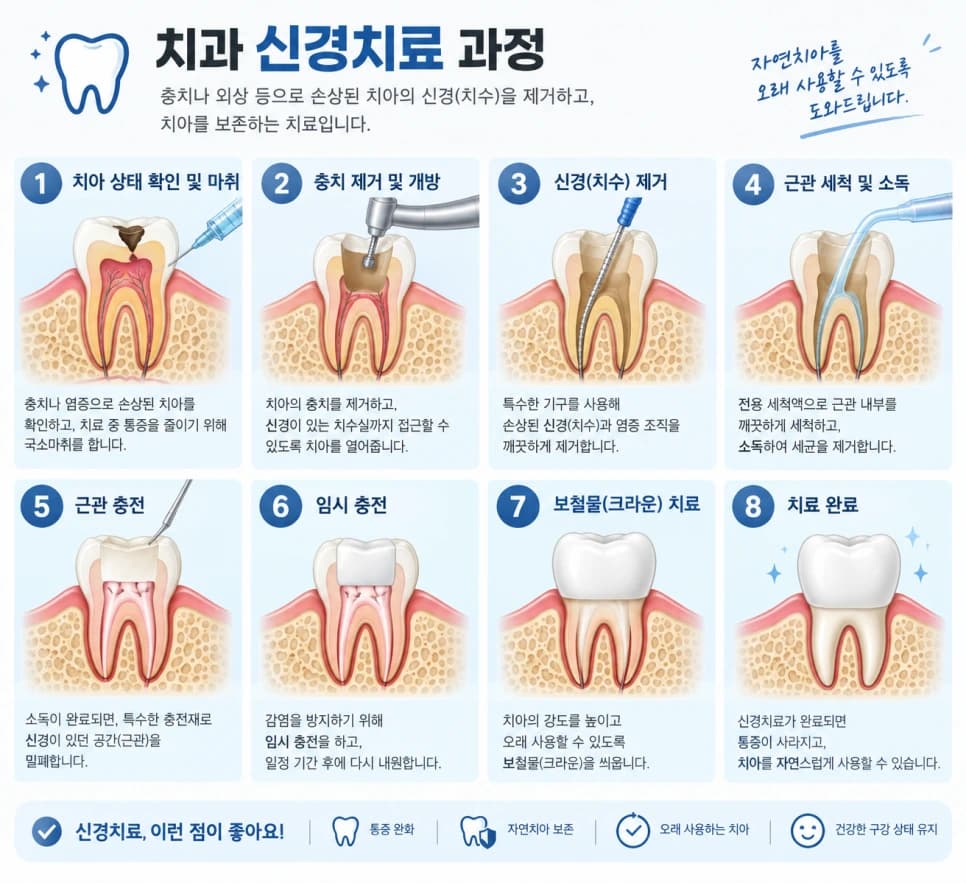 신경치료의 검사부터 보철치료까지 정리한 원문 단계별 안내 그림