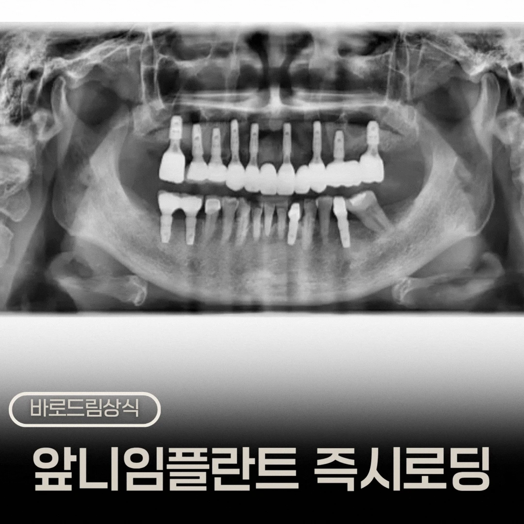 원문 첫 미디어에서 순차 표시한 파노라마 비교 애니메이션