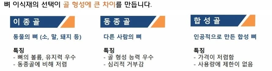 뼈이식 재료의 특징을 비교한 원문 설명 표