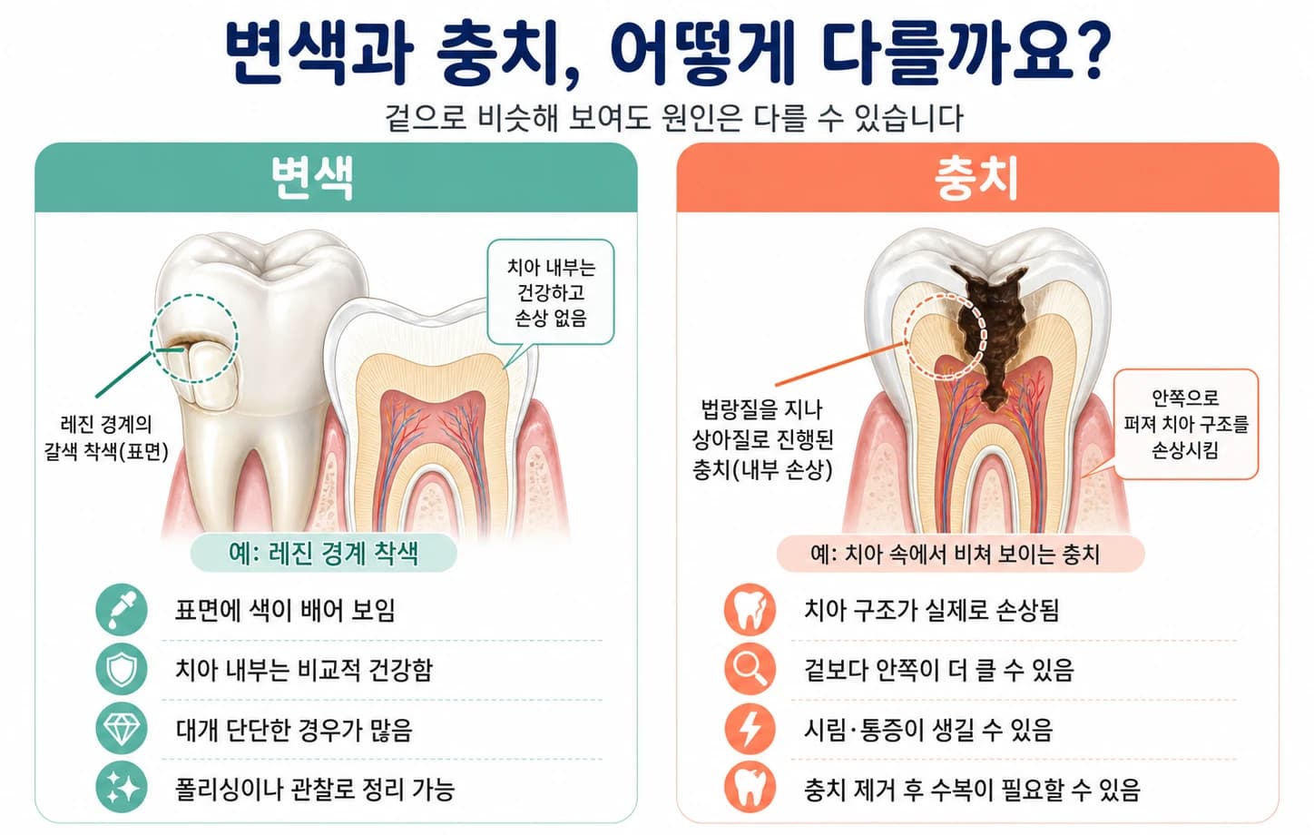 수복 부위를 확인할 수 있는 원문의 추가 구강사진