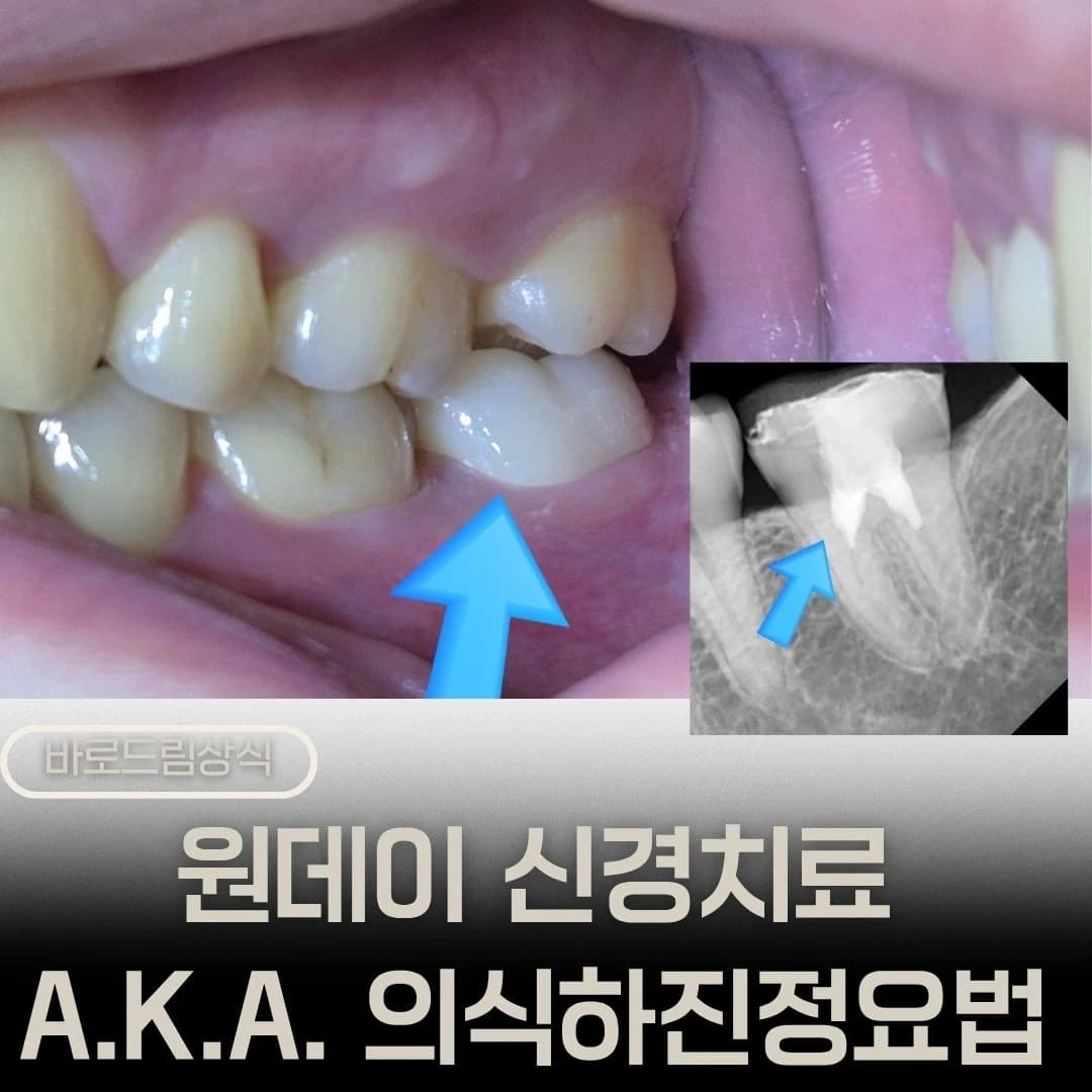 원문에 삽입된 의식하진정법 관련 다른 글의 링크 썸네일