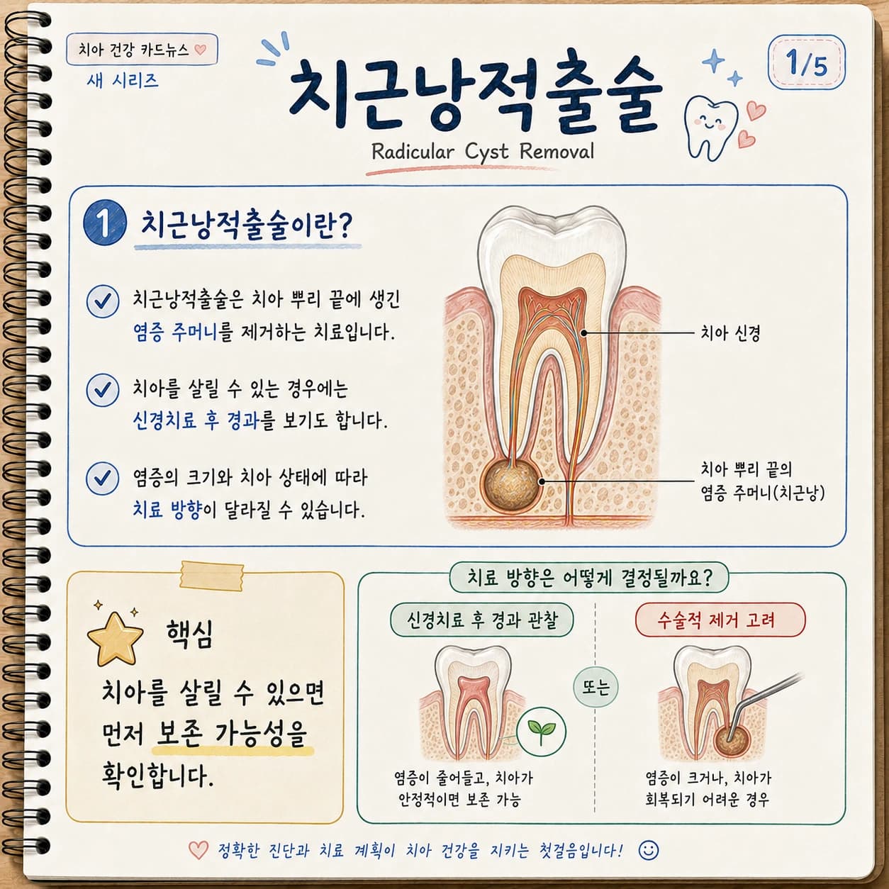치근낭과 주변 뼈의 관계 및 치료 개념을 보여주는 원문 설명 그림