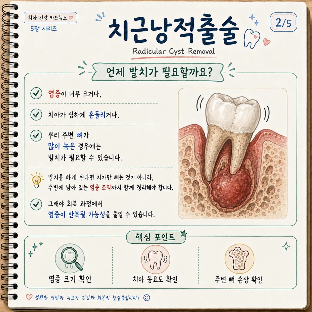 발치와 염증 조직 제거 및 임시치아 계획을 설명한 원문 그림