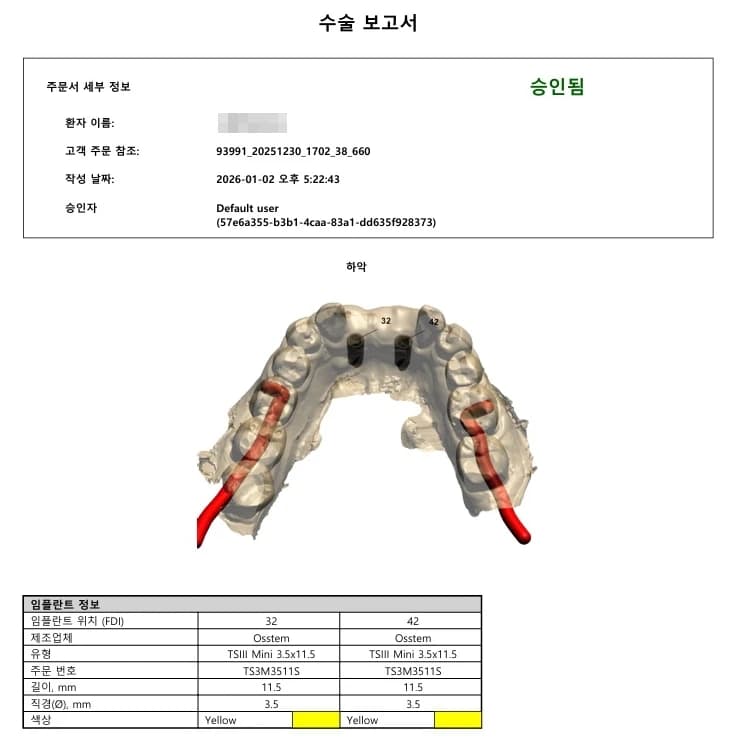 원문에 제시된 임플란트 수술 보고서