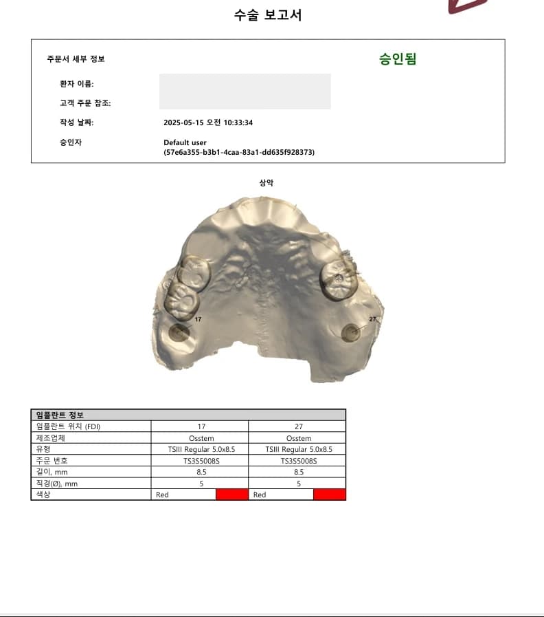 기존 임플란트와의 관계를 고려한 수술계획 보고서