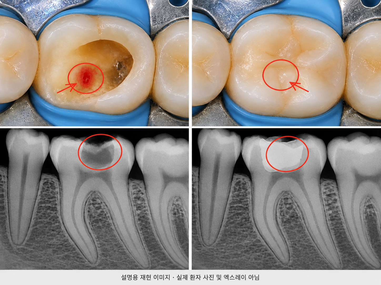 향남치과 향남충치치료